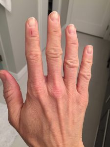 10-2016-02-12-hands-month-13-1